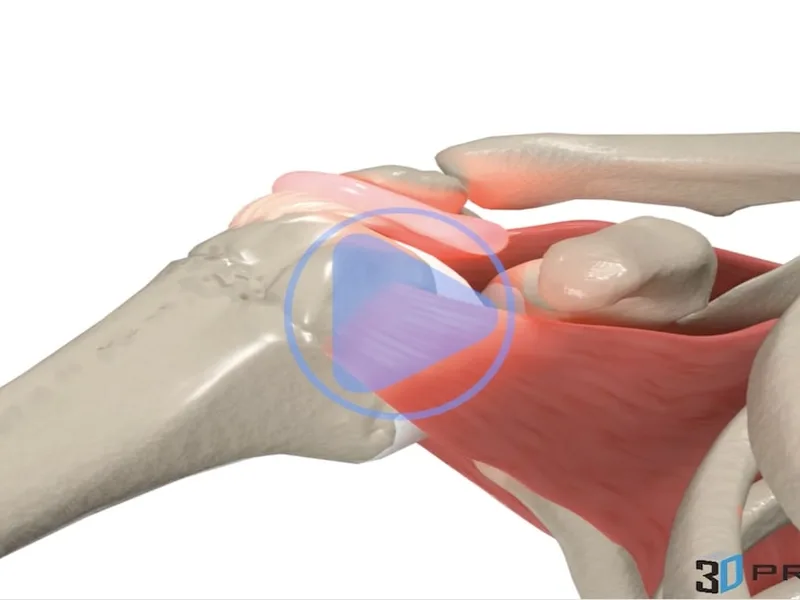 Impingement Syndrome — 3D anatomical animation
