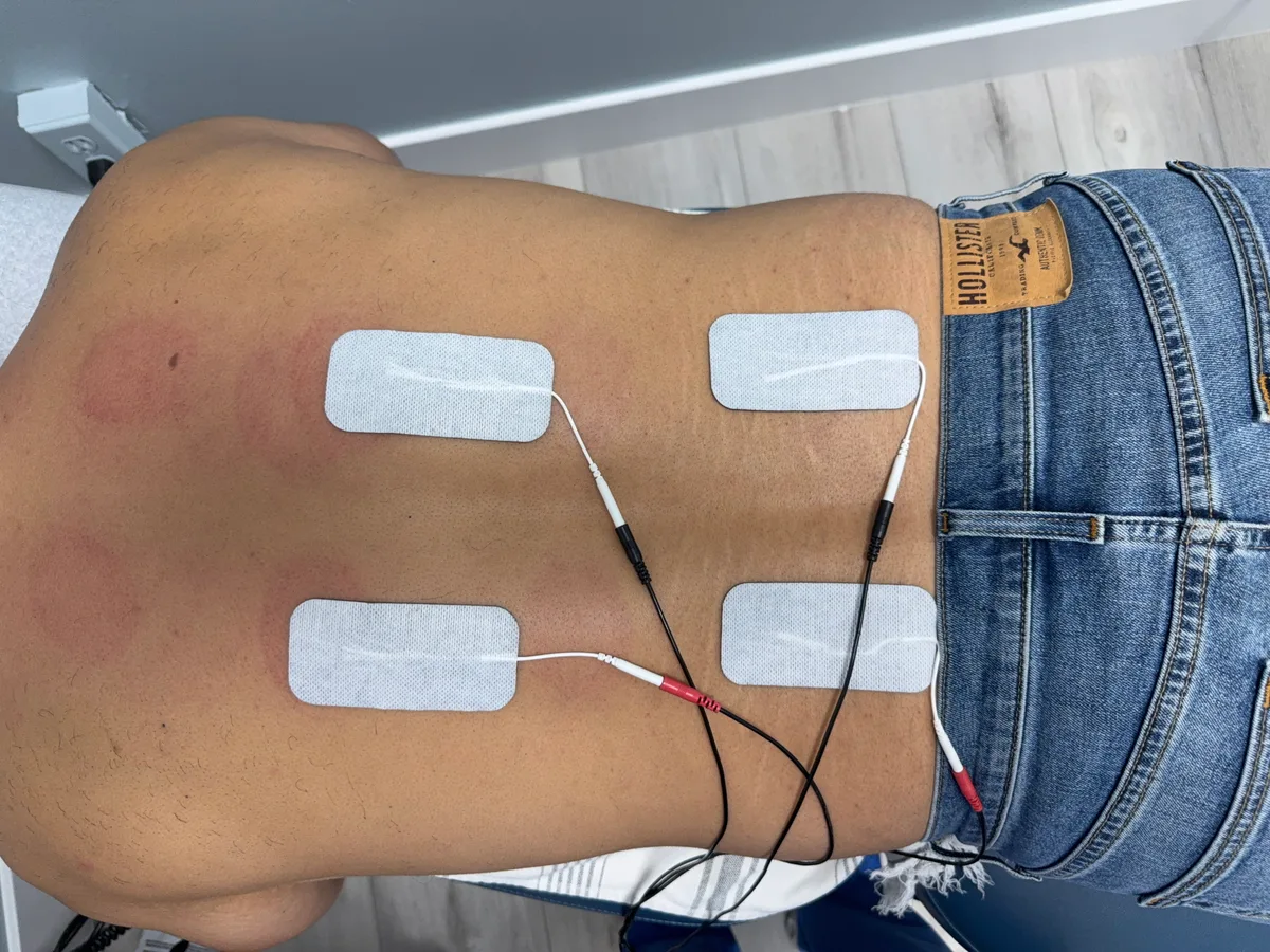 How Electrical Muscle Stimulation (EMS) works at Divine Healing Chiropractic