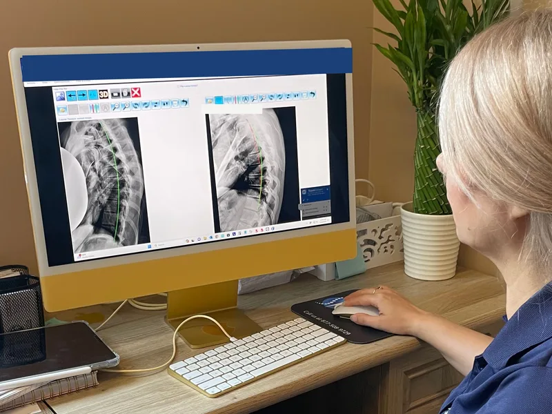 How X-Rays works at Divine Healing Chiropractic