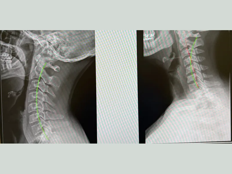 X-Rays at Divine Healing Chiropractic in Laguna Niguel