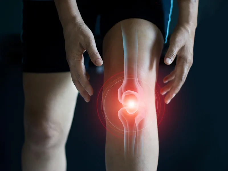 How Divine Healing Chiropractic treats arthritis in Laguna Niguel